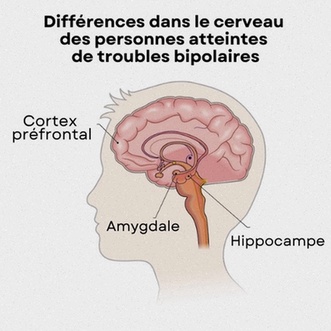 traitement bipolarité en ligne